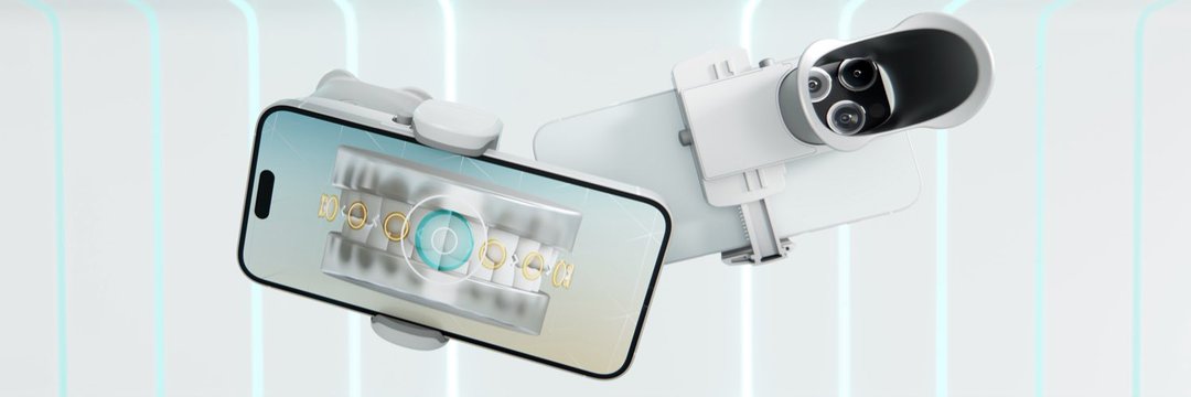 Dental Monitoring